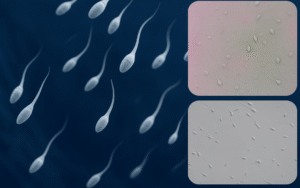 Book Your Private Semen Analysis in London Today!