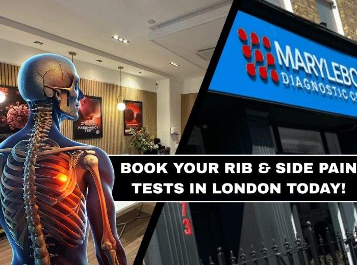 Book Your Rib and Side Pain Tests in London Today What Tests You Need at Marylebone Diagnostic Centre
