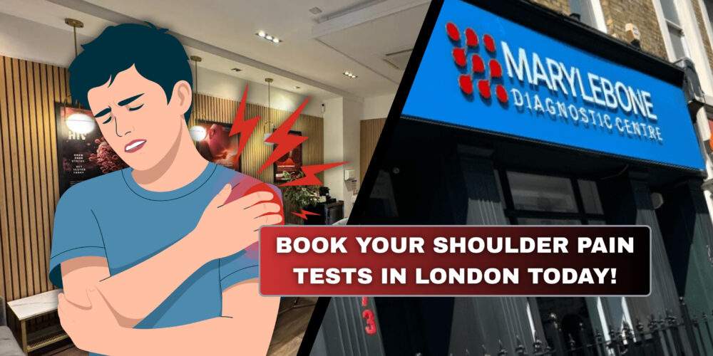 Book Your Shoulder Pain Tests in London Today What Tests You Need at Marylebone Diagnostic Centre