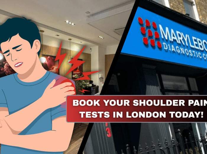 Book Your Shoulder Pain Tests in London Today What Tests You Need at Marylebone Diagnostic Centre