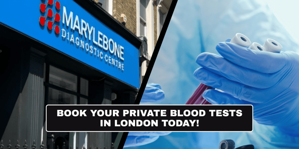 Book Your private blood tests in London Today What Tests You Need at Marylebone Diagnostic Centre