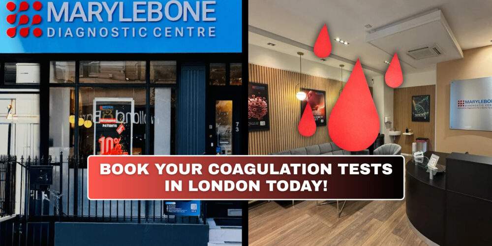 Book Your Coagulation Profile Test in London Today What Tests You Need at Marylebone Diagnostic Centre