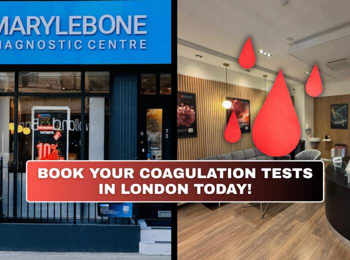 Book Your Coagulation Profile Test in London Today What Tests You Need at Marylebone Diagnostic Centre