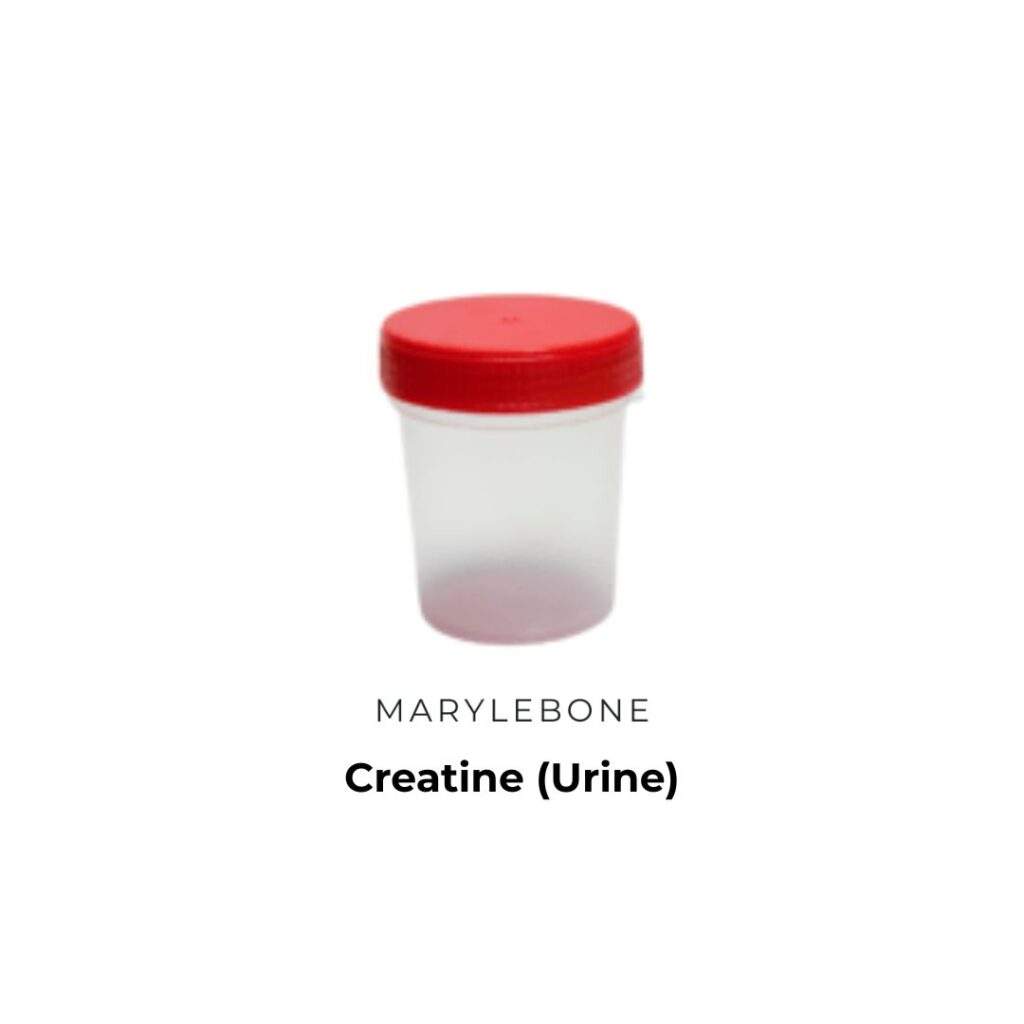 creatine-urine-in-london-at-marylebone-diagnostic-centre
