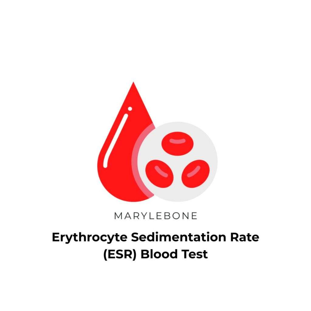 erythrocyte-sedimentation-rate-blood-test-in-london-at-marylebone-diagnostic-centre
