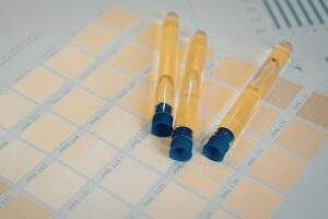 Cotinine Testing