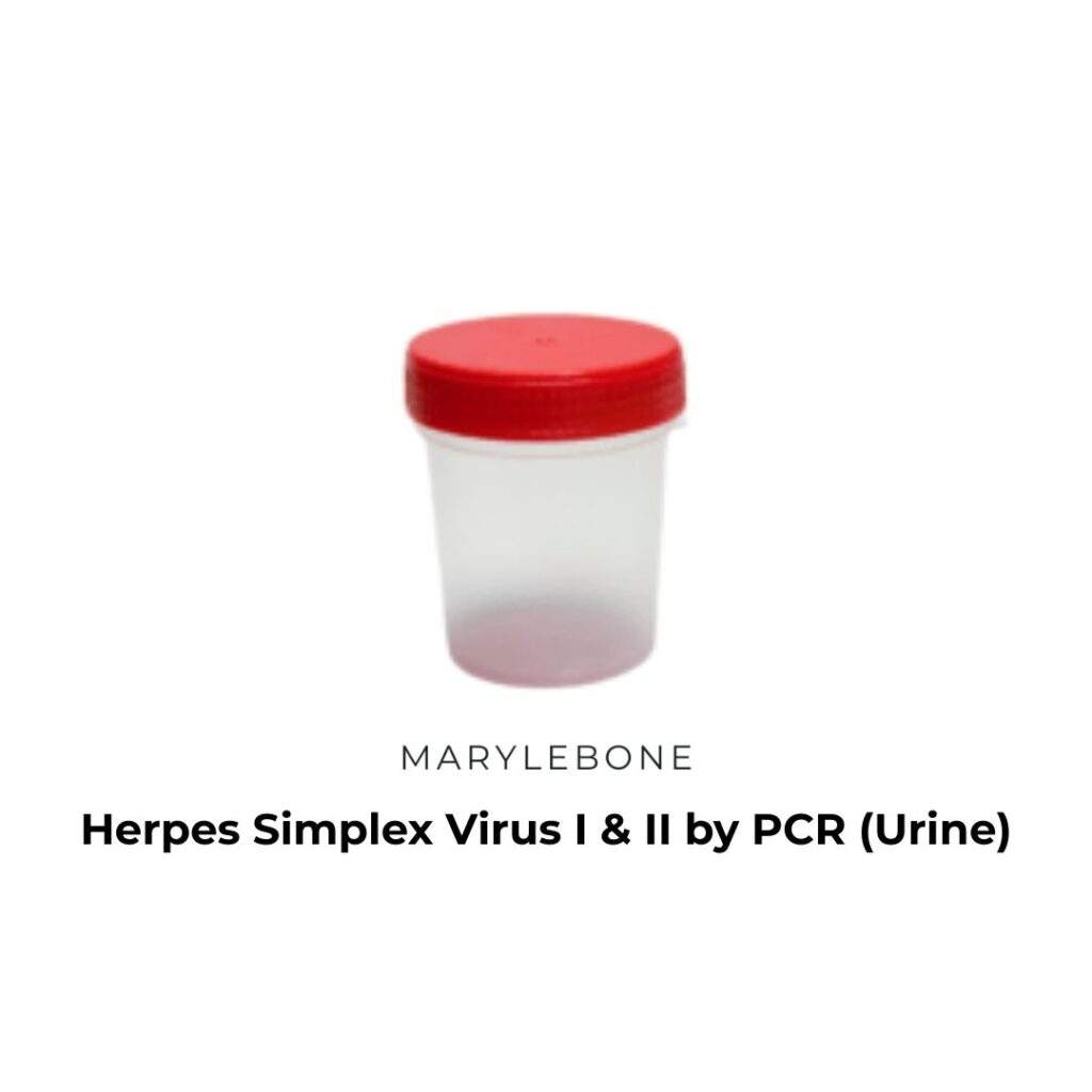 Herpes Simplex Virus I & II by PCR (Urine)-test-in-london-at-marylebone-diagnostic-centre