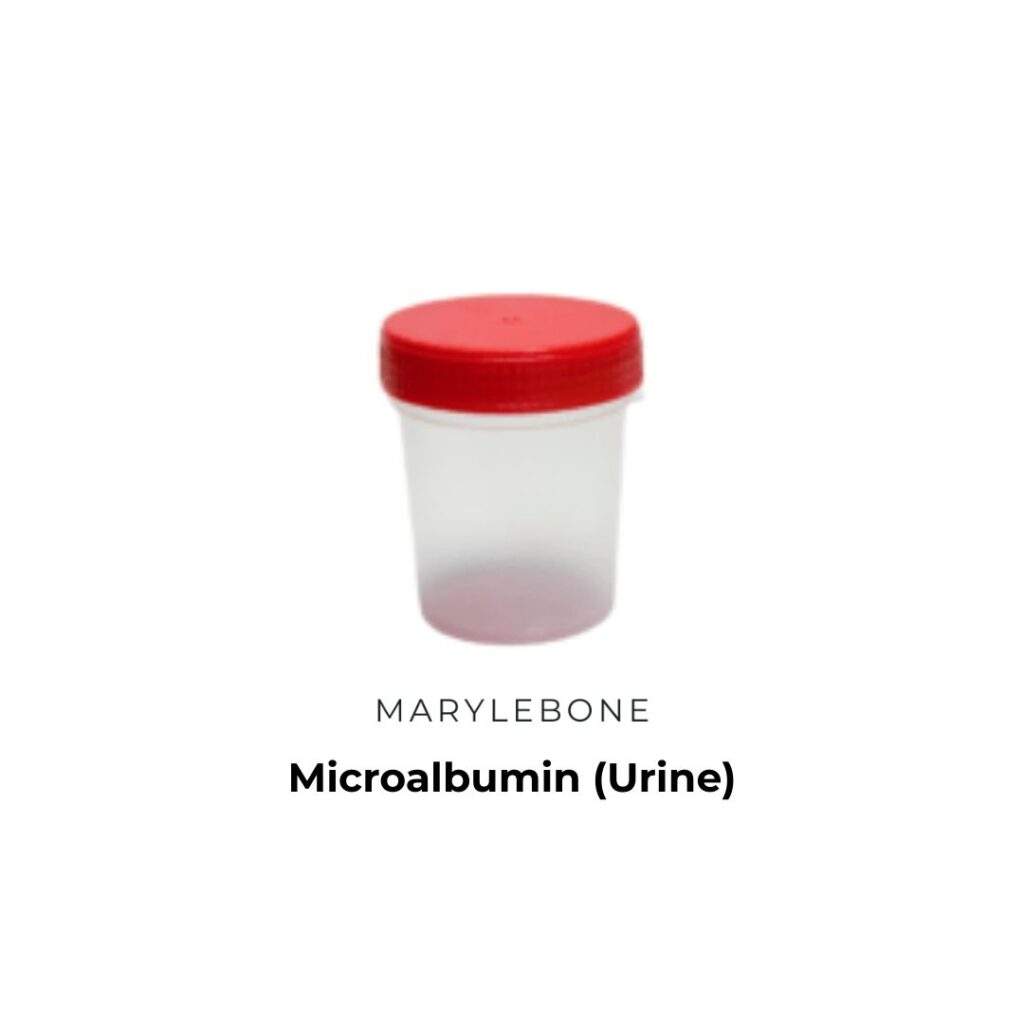 Microalbumin (Urine)-blood-test-in-london-at-marylebone-diagnostic-centre
