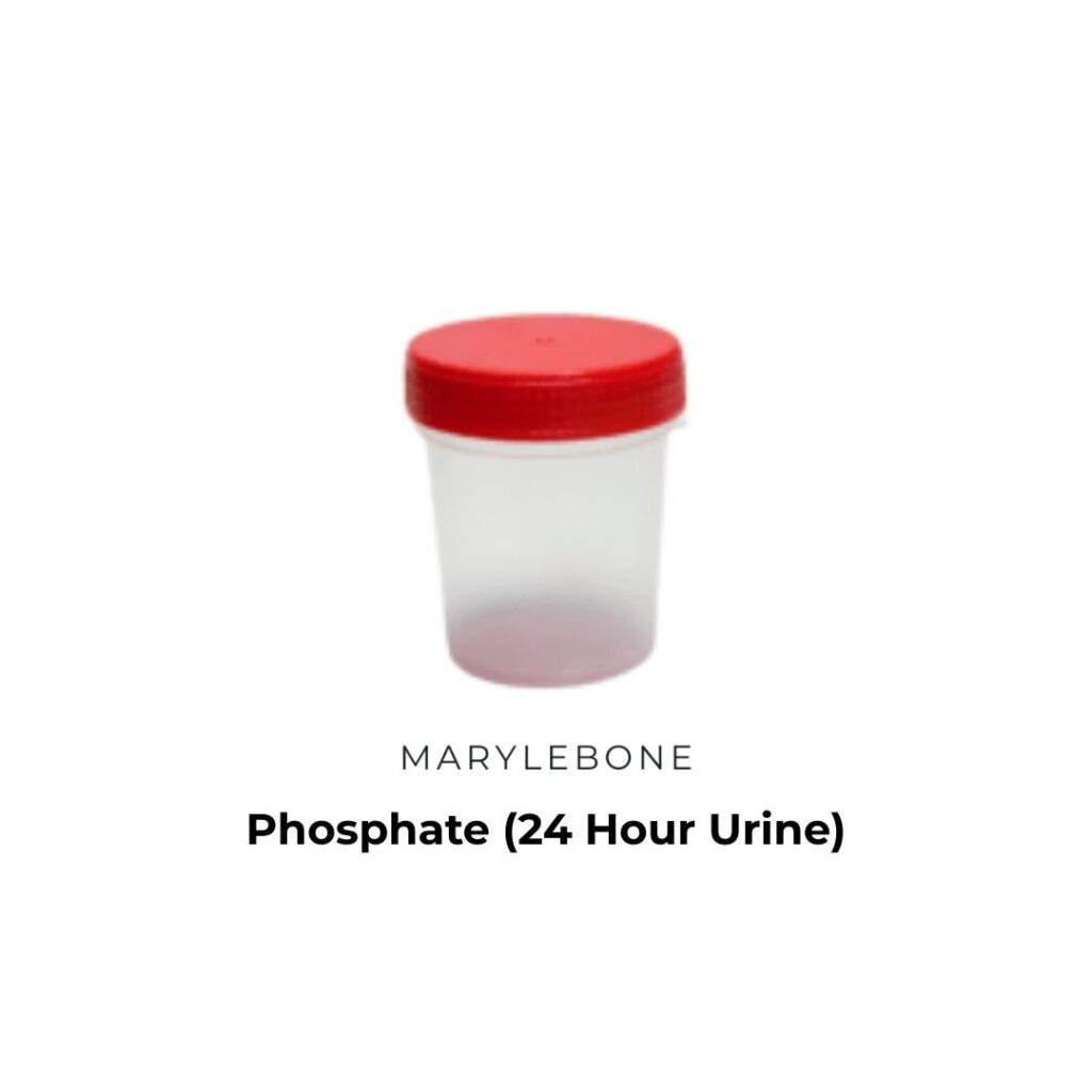 Phosphate (24 Hour Urine)-blood-test-in-london-at-marylebone-diagnostic-centre