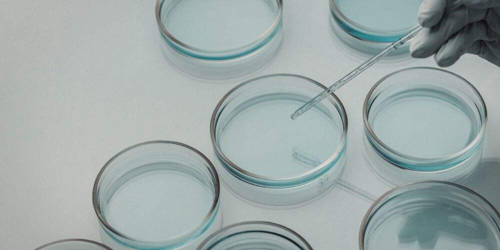 Semen Analysis in London