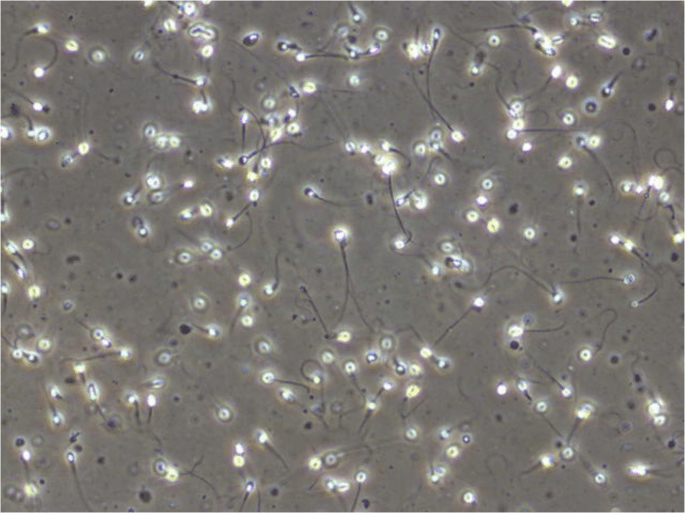 Sperm Health Analysis