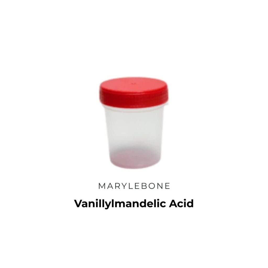 Vanillylmandelic Acid Test