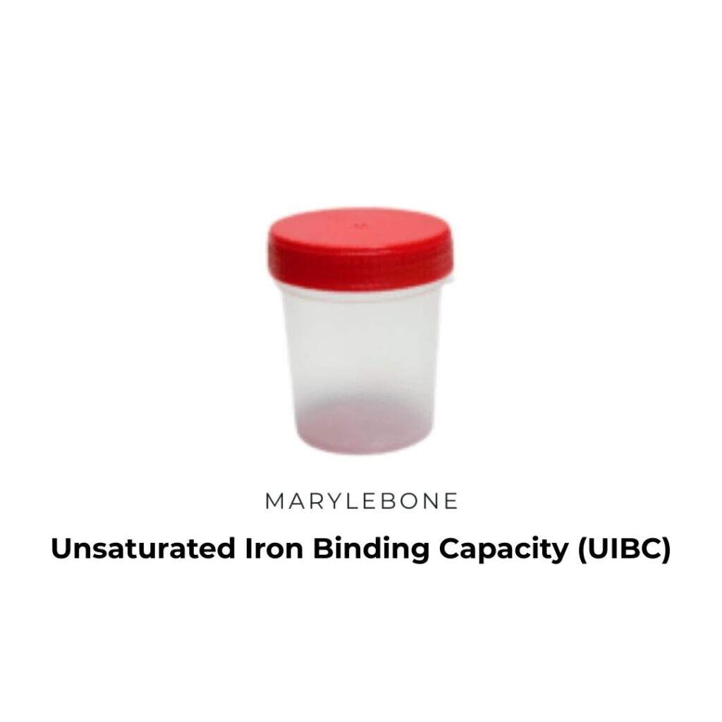Unsaturated Iron Binding Capacity (UIBC) Test