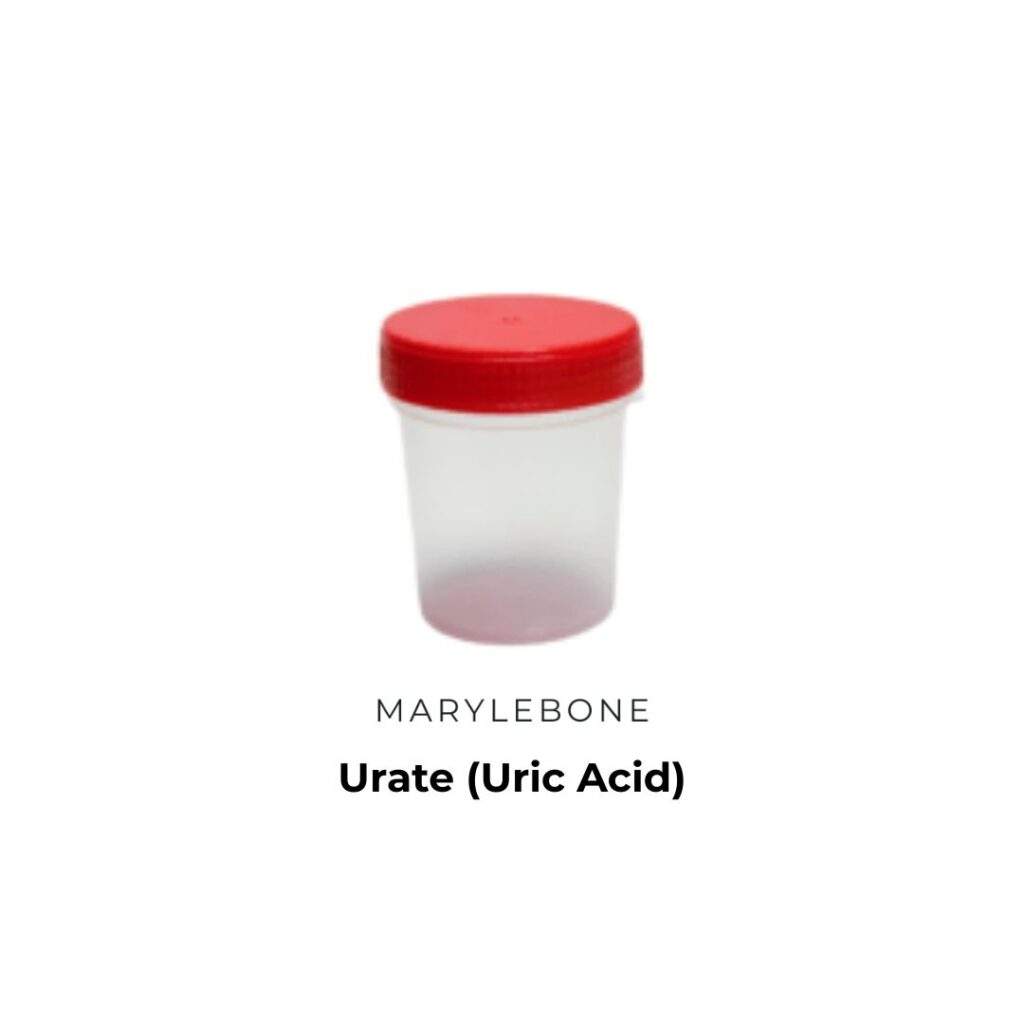 Urate (Uric Acid) Test