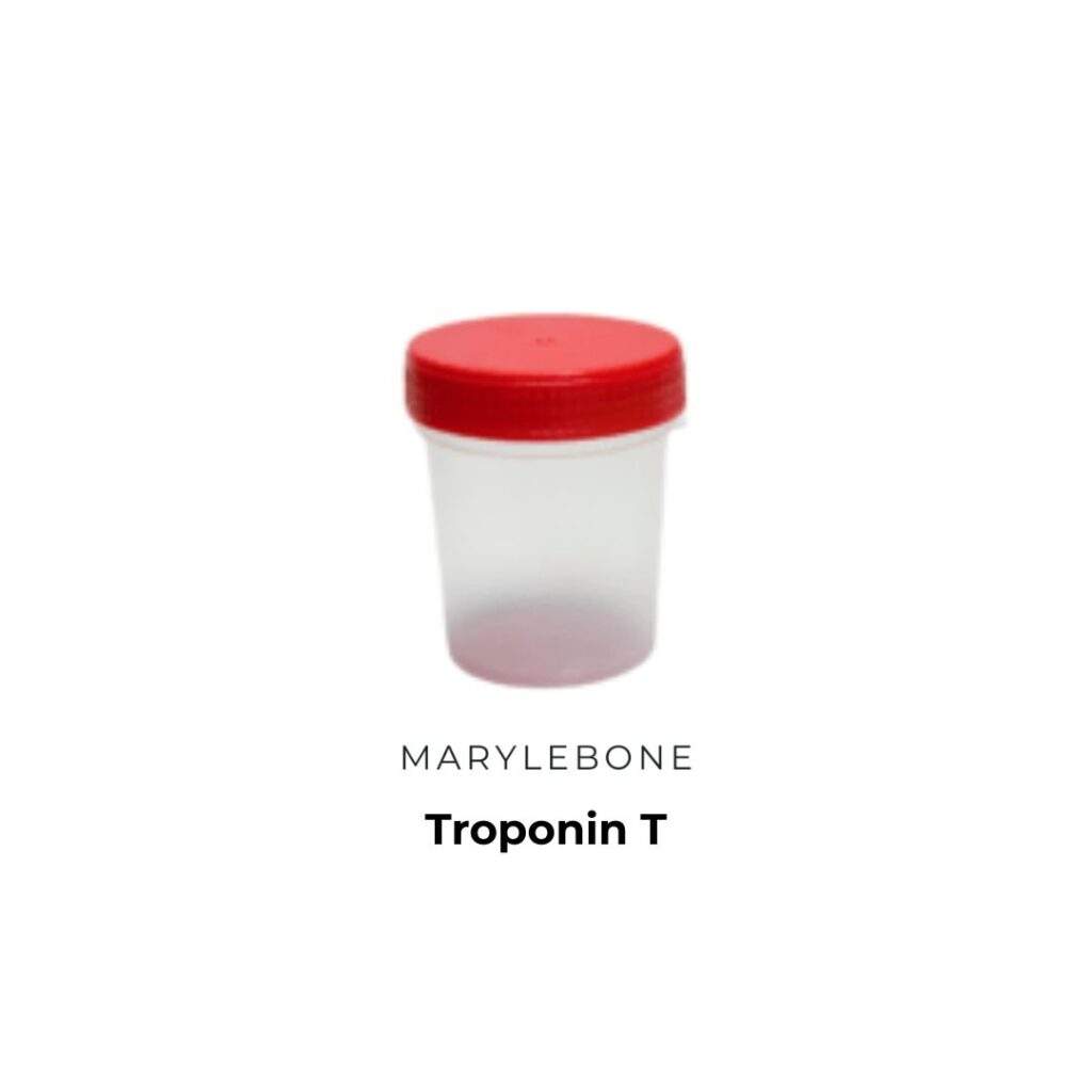 Troponin T Test