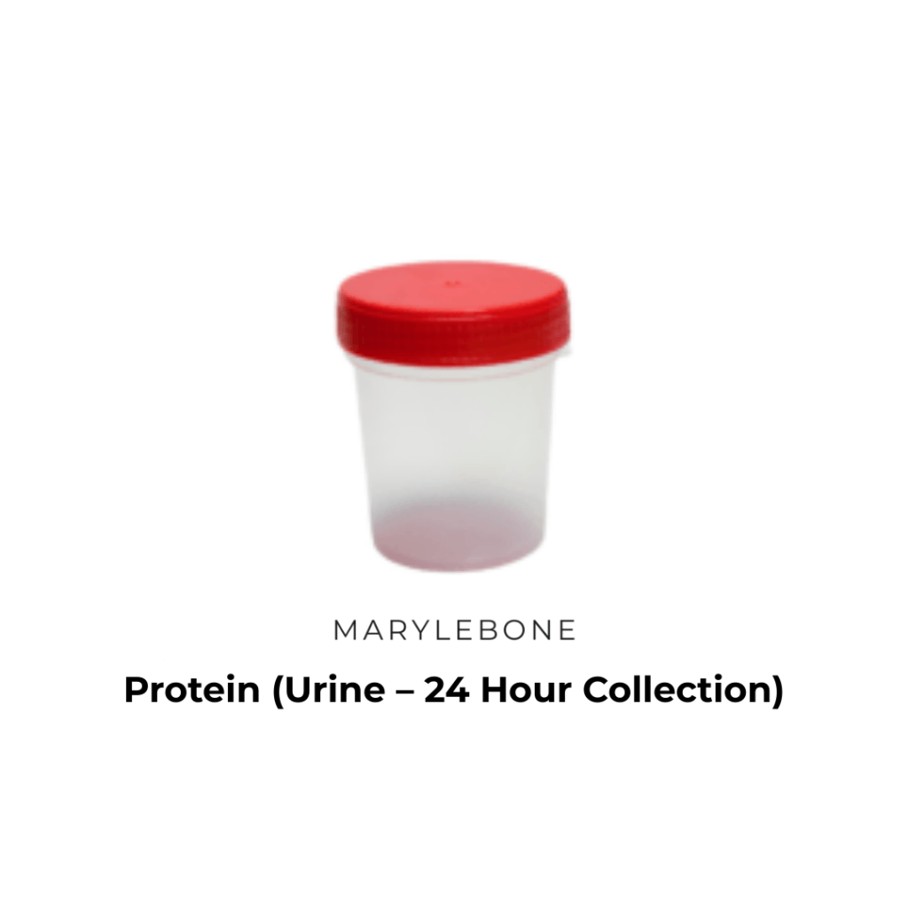 Protein (Urine – 24a Hour Collection) test in Marylbone