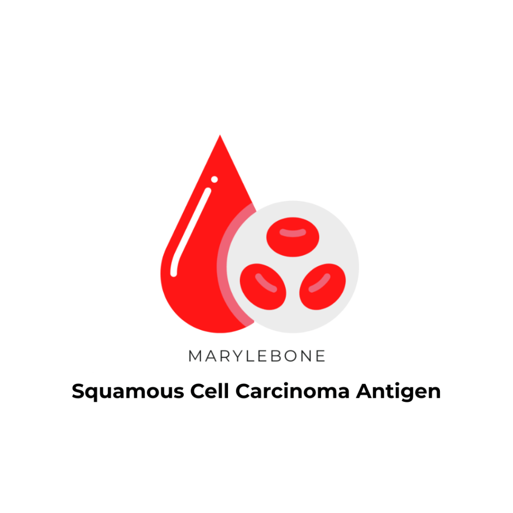 Squamous Cell Carcinoma Antigen test in Marylbone