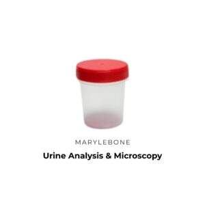 Urine Analysis & Microscopy Test in Marylbone