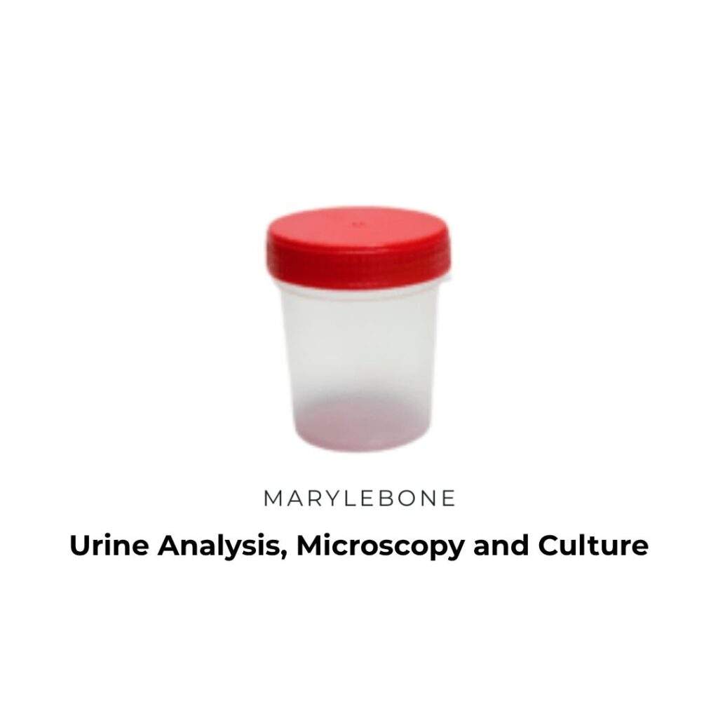 _Urine Analysis, Microscopy and Culture Test in Marylbone