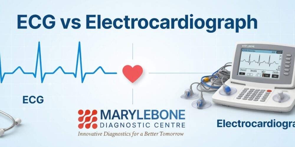What is the difference between an electrocardiogram and an electrocardiograph?