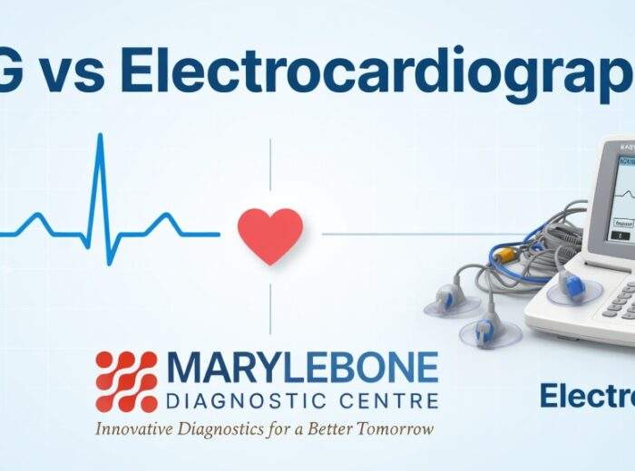 What is the difference between an electrocardiogram and an electrocardiograph?
