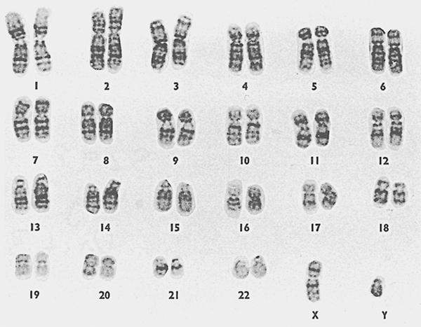 Karyotype genetic testing consultation