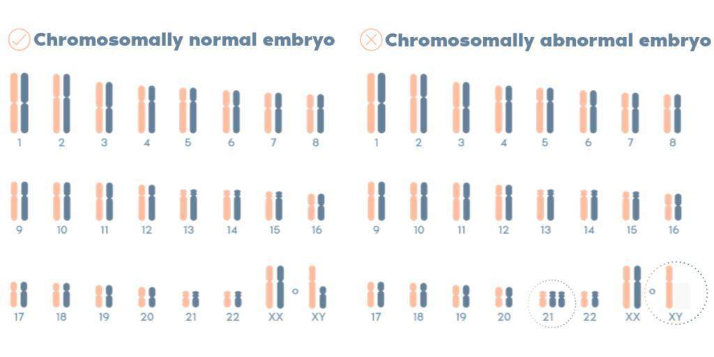 Karyotype laboratory process