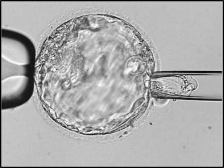Embryo Genetic Assessment