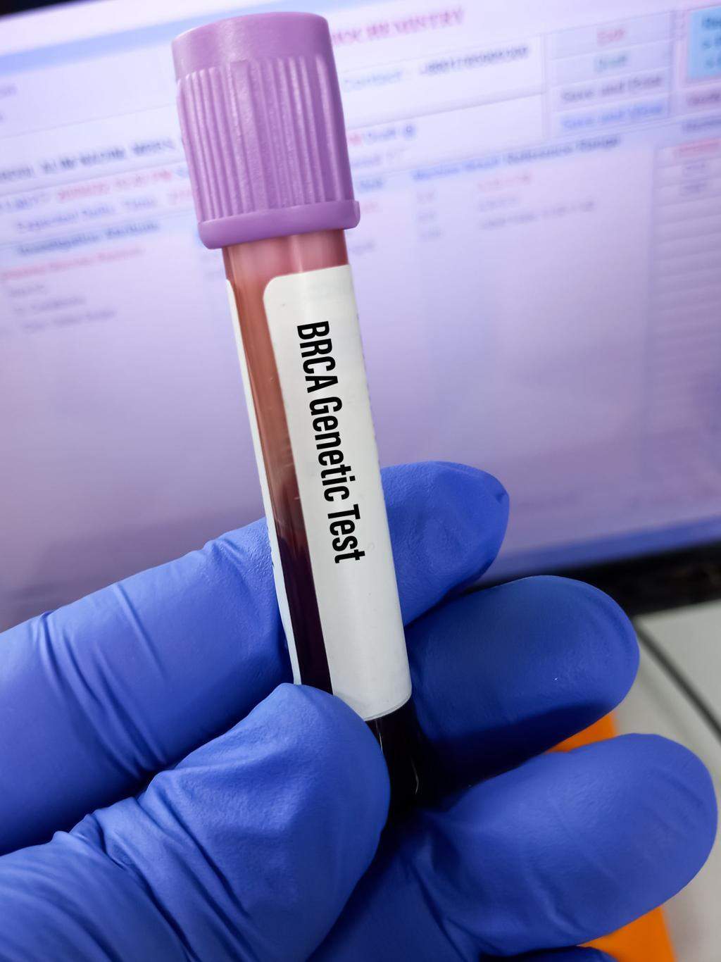 BRCA genetic counselling