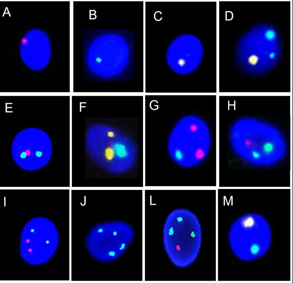 FISH sperm analysis consultation