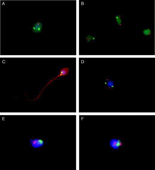 Sperm chromosome analysis