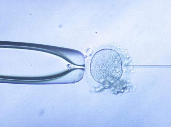 FISH Sperm Analysis London – Chromosome Testing for Male Fertility