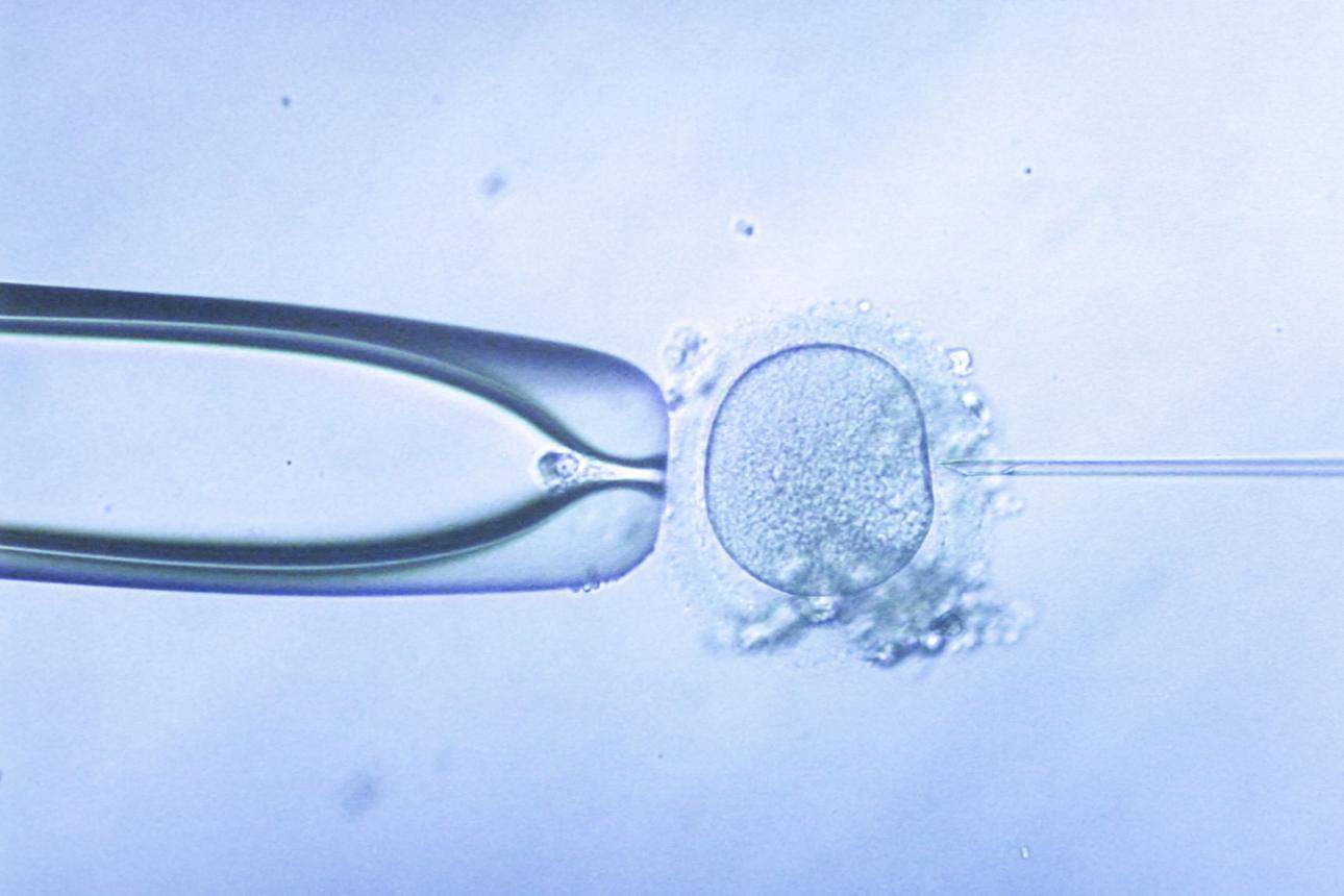Advanced sperm chromosome testing