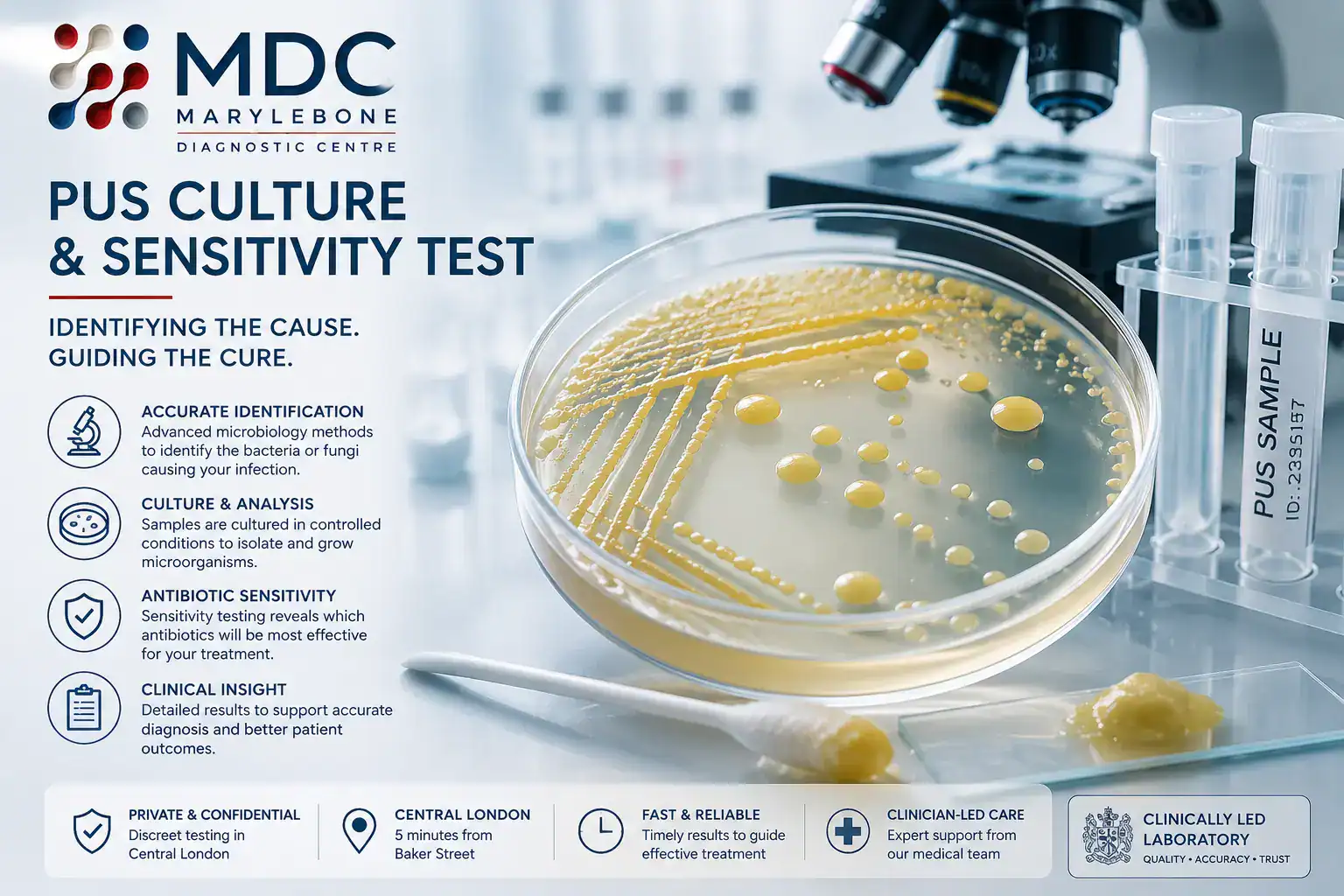 Pus culture and sensitivity sample collection at Marylebone Diagnostic Centre, Baker Street